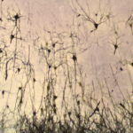 coupe de néocortex de rat coloré au nitrate d’argent par la méthode de Golgi qui permet de colorer en noir une partie des neurones